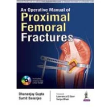 AN OPERATIVE MANUAL OF PROXIMAL FEMORAL FRACTURES By Dhananjay Gupta (original)